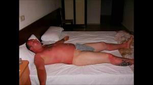 19 от най-лошите слънчеви изгаряния и тен КОГДА