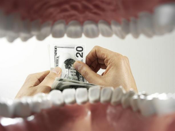 Diş maliyetleri